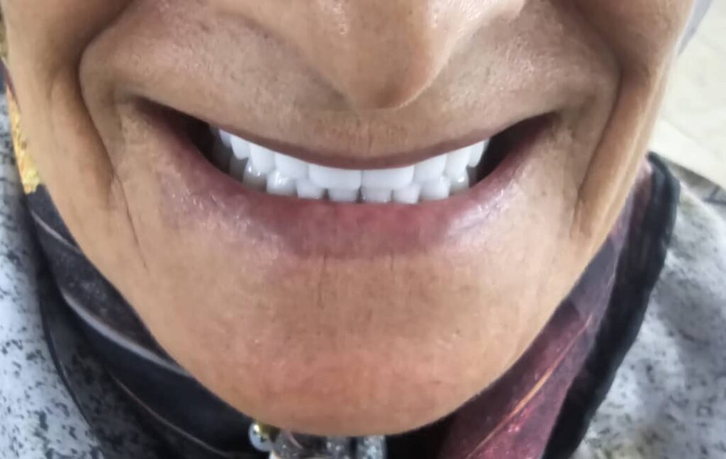 دندانسازی مکاریان در بوشهر