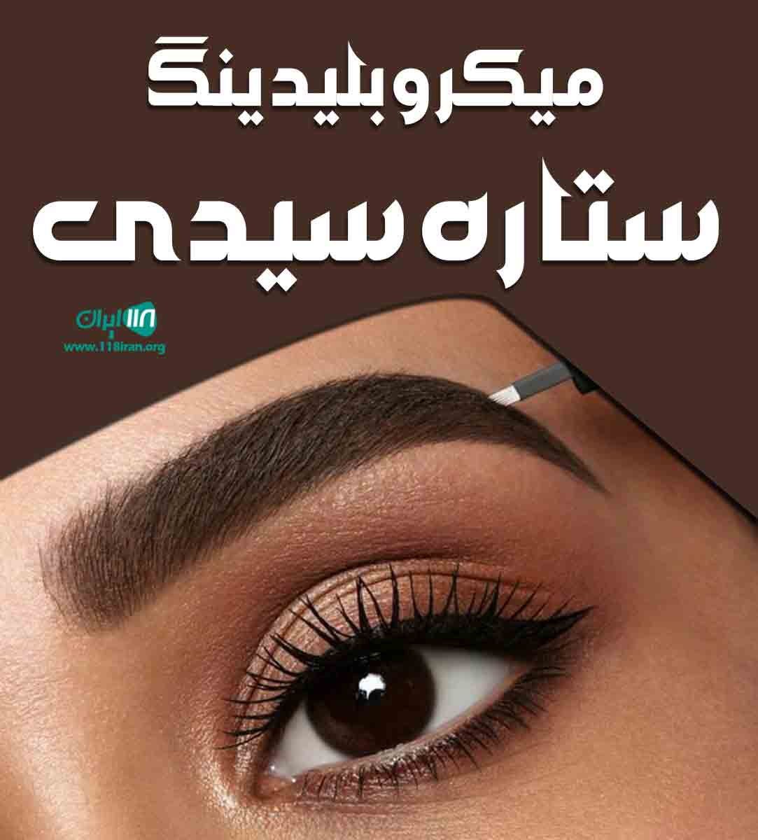 میکروبلیدینگ ستاره سیدی در رشت میکروبلیدینگ ستاره سیدی در رشت