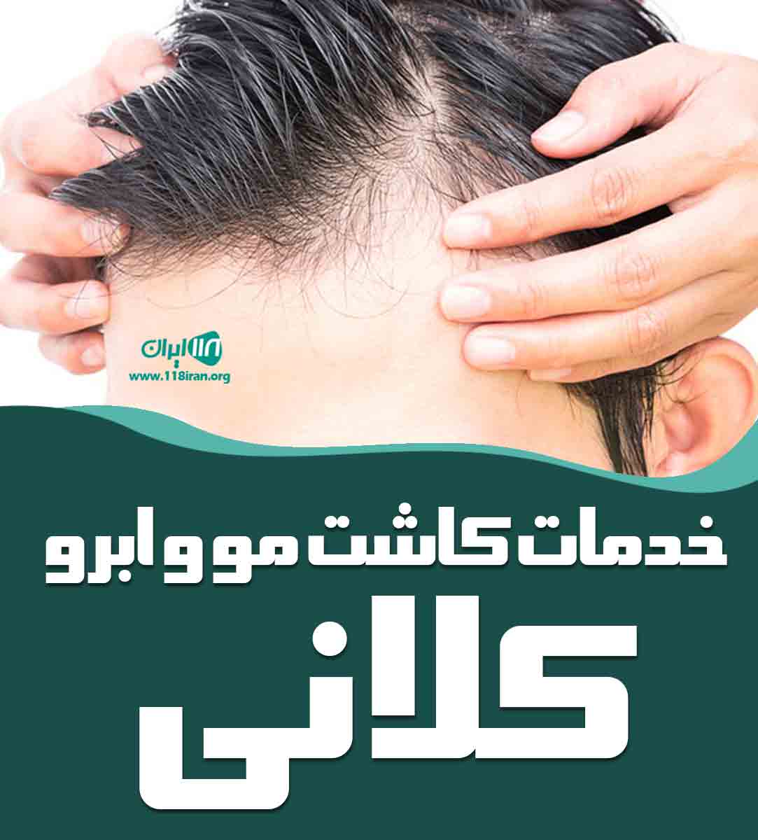خدمات کاشت مو و ابرو کلانی در مشهد