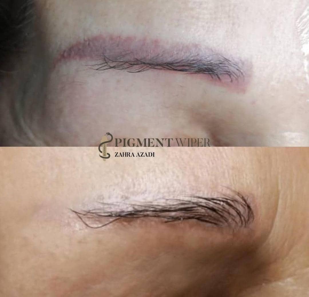 خدمات ریمو تاتو زهرا آزادی در شیراز