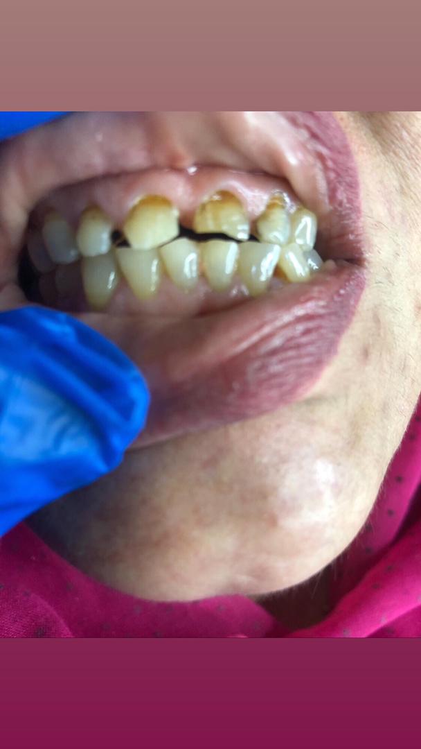 دندانسازی مهران دنتال در بندرعباس دندانسازی مهران دنتال در بندرعباس