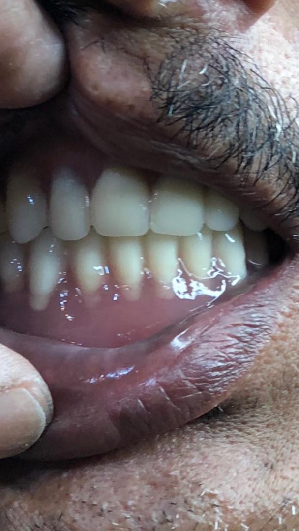 دندانسازی مهران دنتال در بندرعباس دندانسازی مهران دنتال در بندرعباس