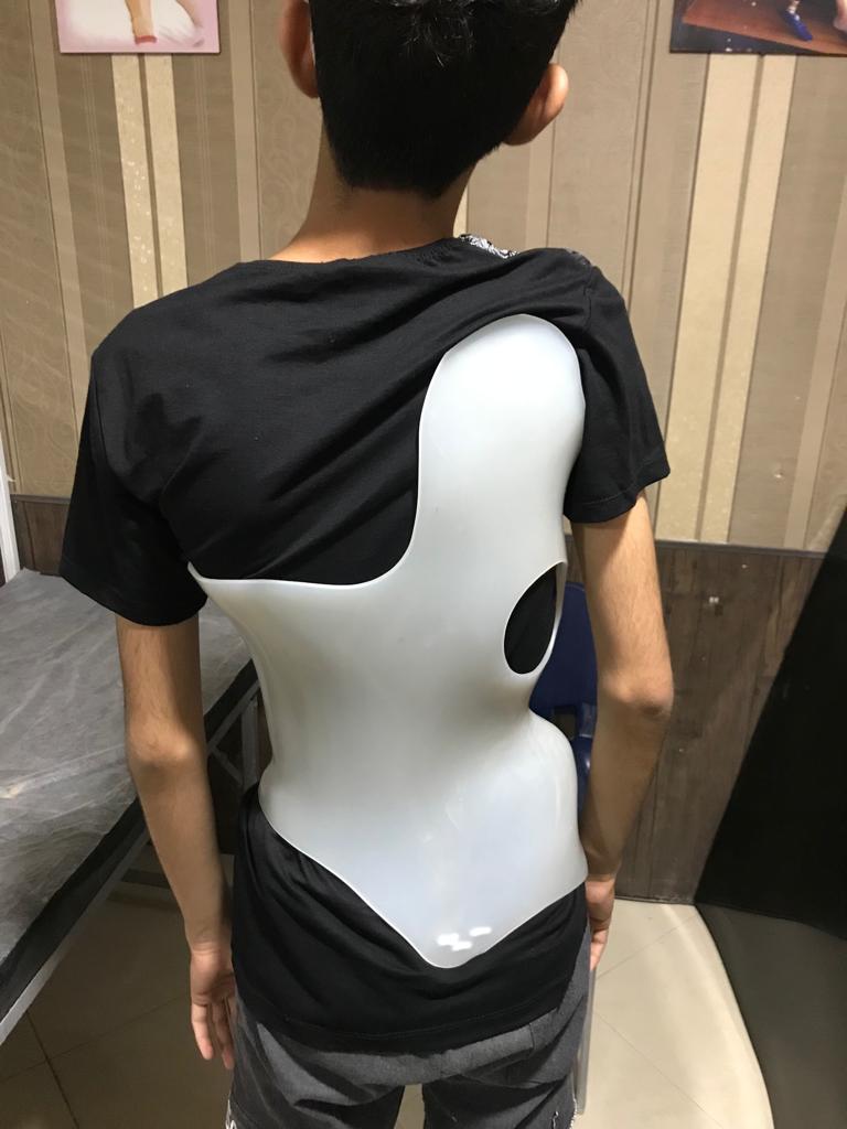 کلینیک ارتوپدی فنی ایرانیان در ساری