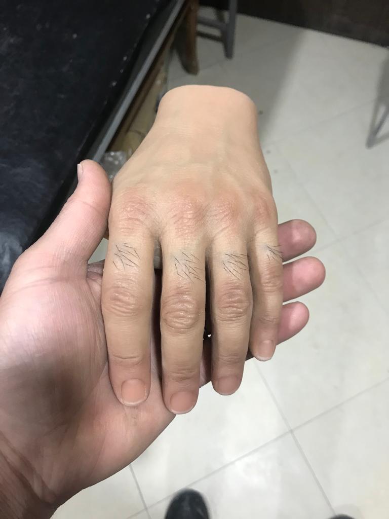 کلینیک ارتوپدی فنی ایرانیان در ساری