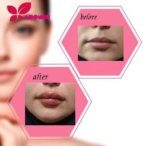 کلینیک زیبایی پوست و مو و لیزر آدونیس در لاهیجان کلینیک زیبایی پوست و مو و لیزر آدونیس در لاهیجان