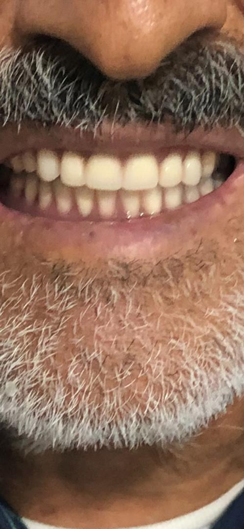 دندانسازی مهران دنتال در بندرعباس دندانسازی مهران دنتال در بندرعباس