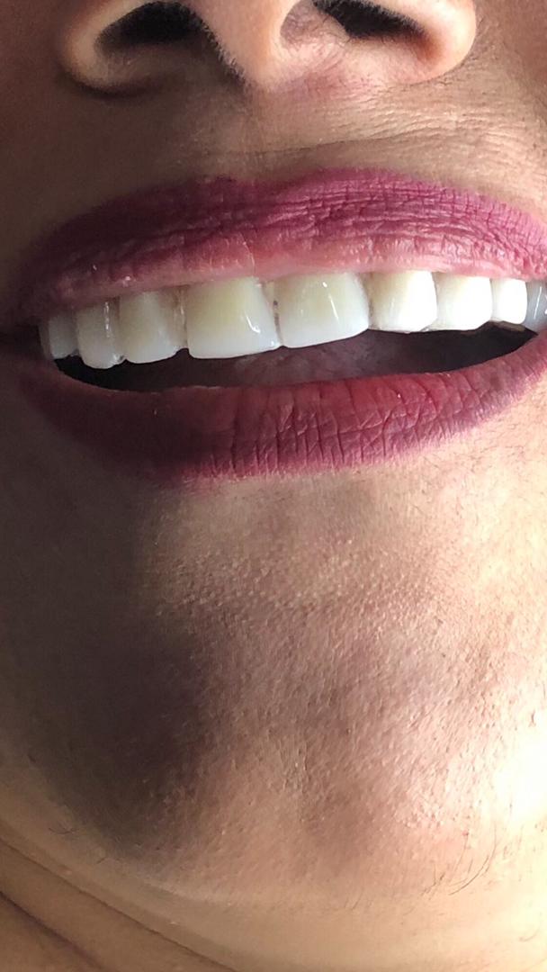 دندانسازی مهران دنتال در بندرعباس دندانسازی مهران دنتال در بندرعباس