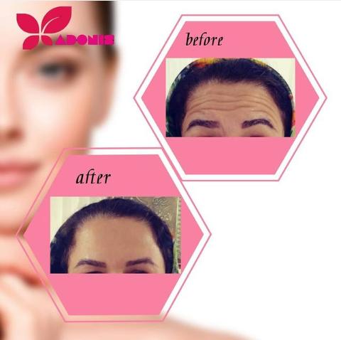 کلینیک زیبایی پوست و مو و لیزر آدونیس در لاهیجان کلینیک زیبایی پوست و مو و لیزر آدونیس در لاهیجان