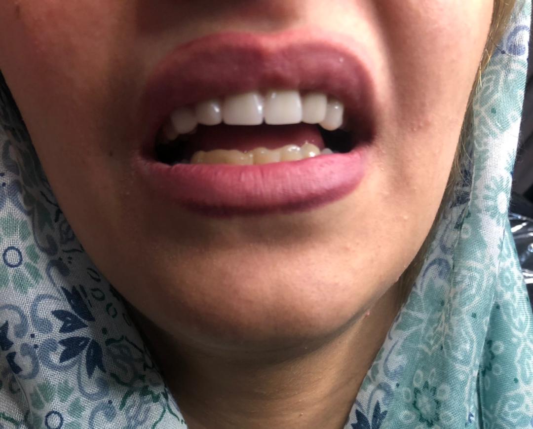 دندانسازی مهران دنتال در بندرعباس دندانسازی مهران دنتال در بندرعباس