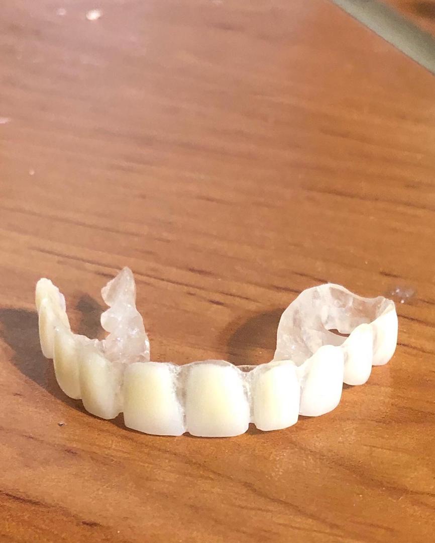 دندانسازی مهران دنتال در بندرعباس دندانسازی مهران دنتال در بندرعباس