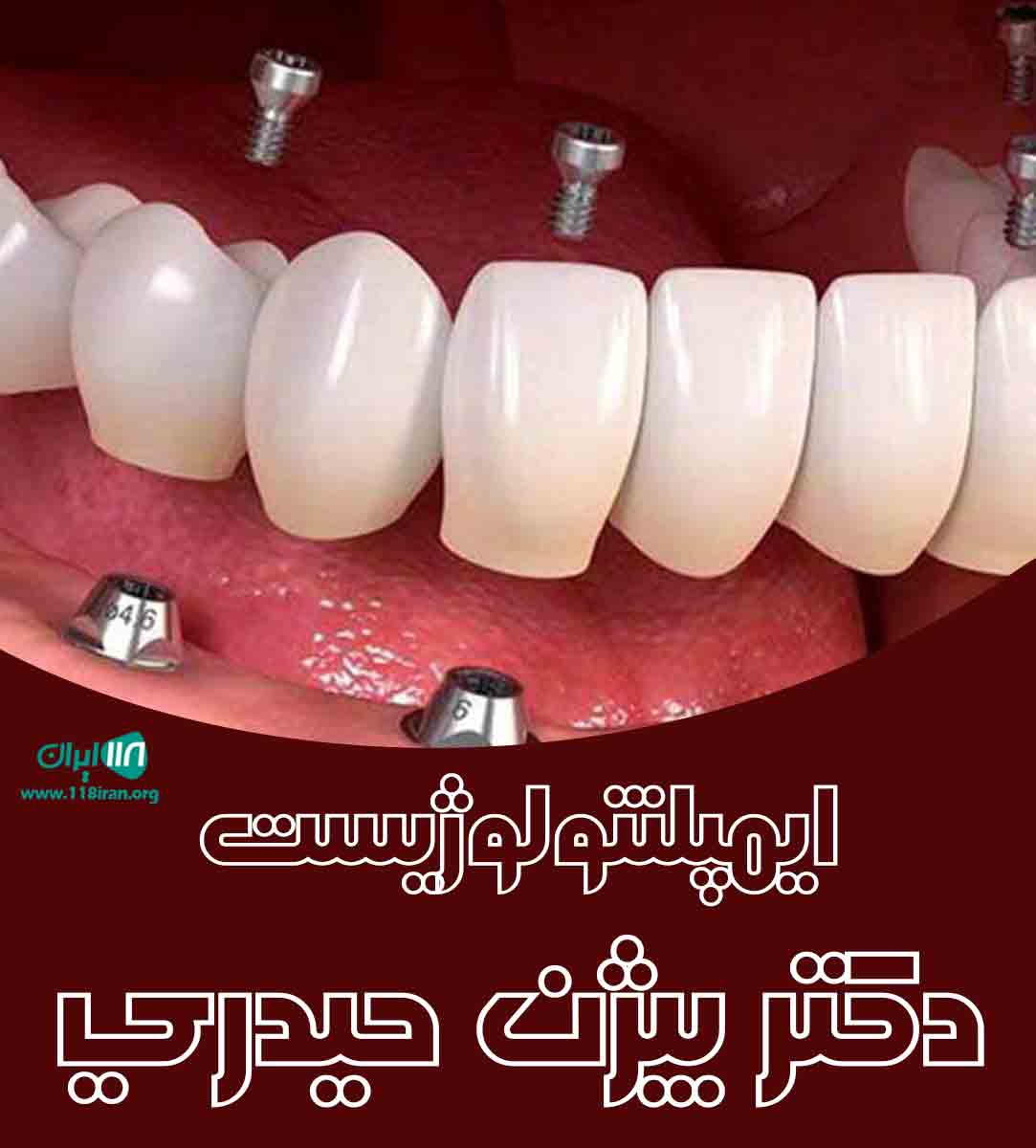 ایمپلنتولوژیست دکتر بیژن حیدری در ارومیه