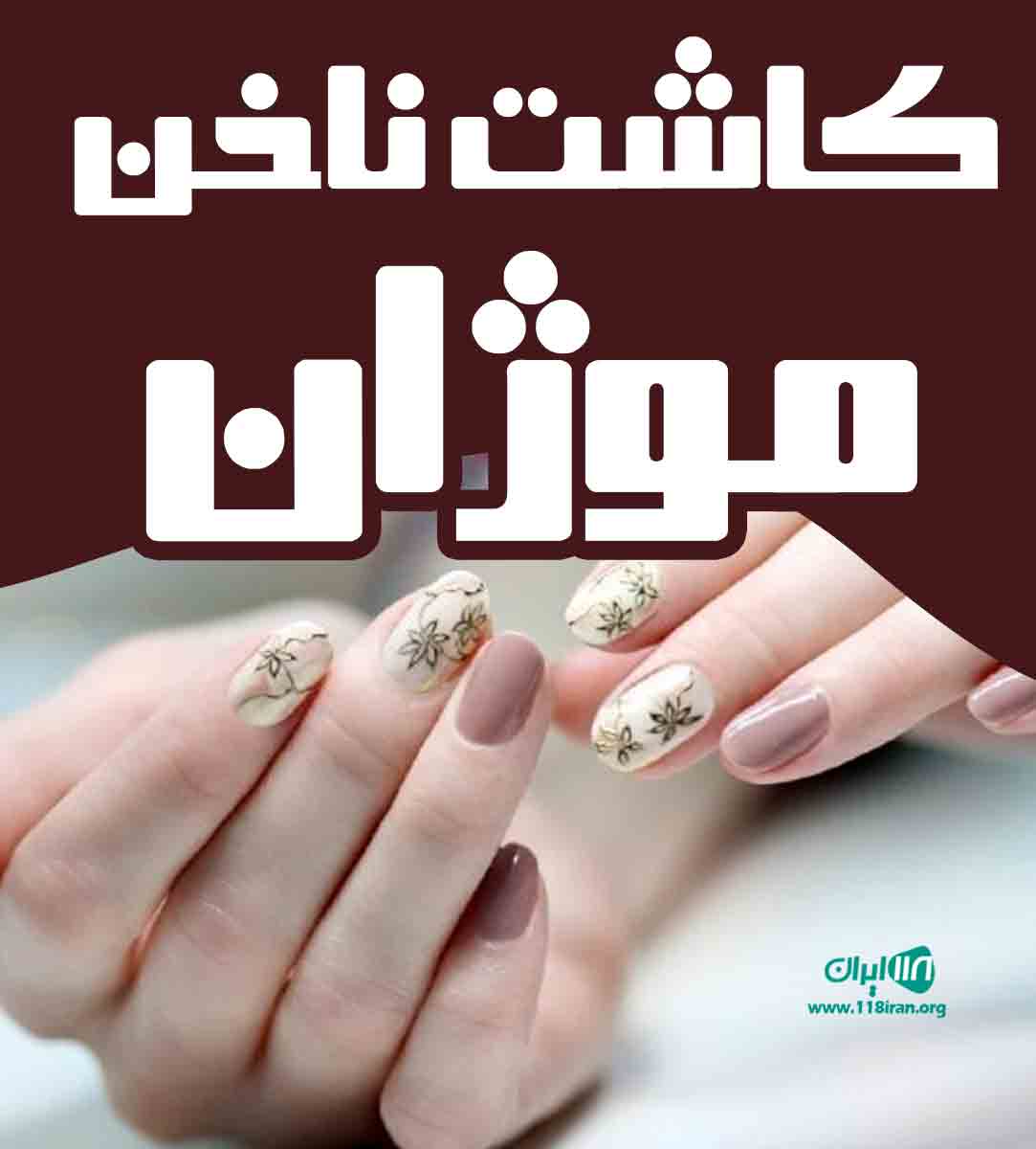 کاشت ناخن موژان در مشهد کاشت ناخن موژان در مشهد