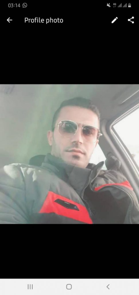 کلینیک کاشت مو دکتر شبان در بیرجند