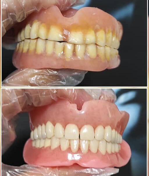 لابراتوار دندانسازی خرم‌دنتال بهاروند در لرستان خرم‌آباد