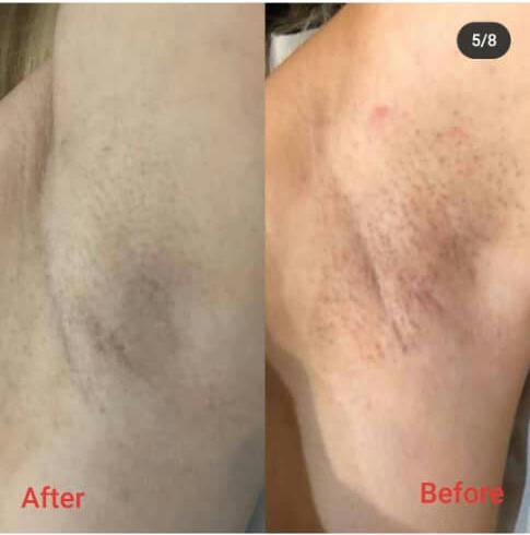 کلینیک پوست مو و لیزر مرندی در ارومیه کلینیک پوست مو و لیزر مرندی در ارومیه