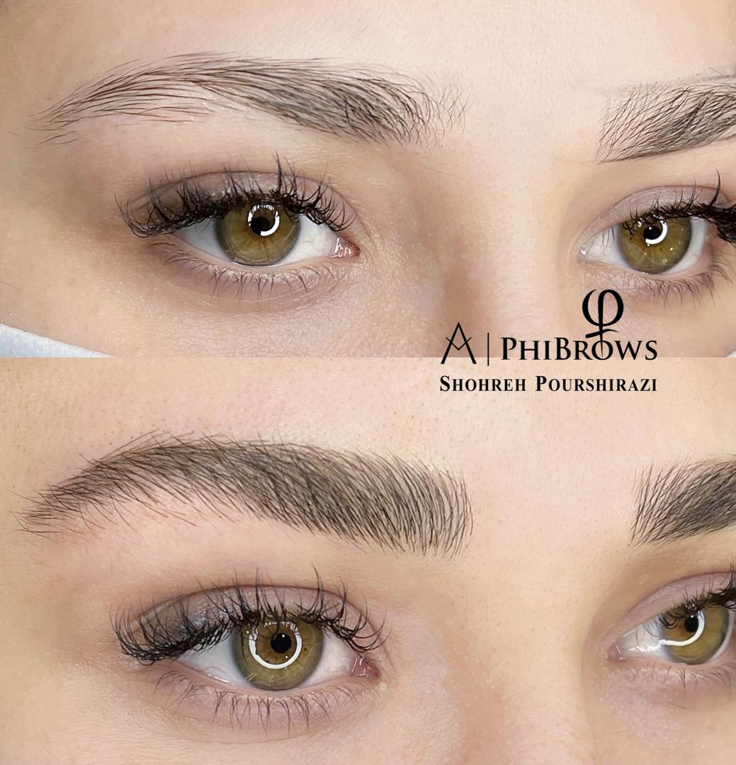 خدمات فیبروز و ریموو تتو شهره پورشیرازی در تهران خدمات فیبروز و ریموو تتو شهره پورشیرازی در تهران