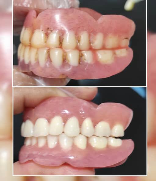 لابراتوار دندانسازی خرم‌دنتال بهاروند در لرستان خرم‌آباد