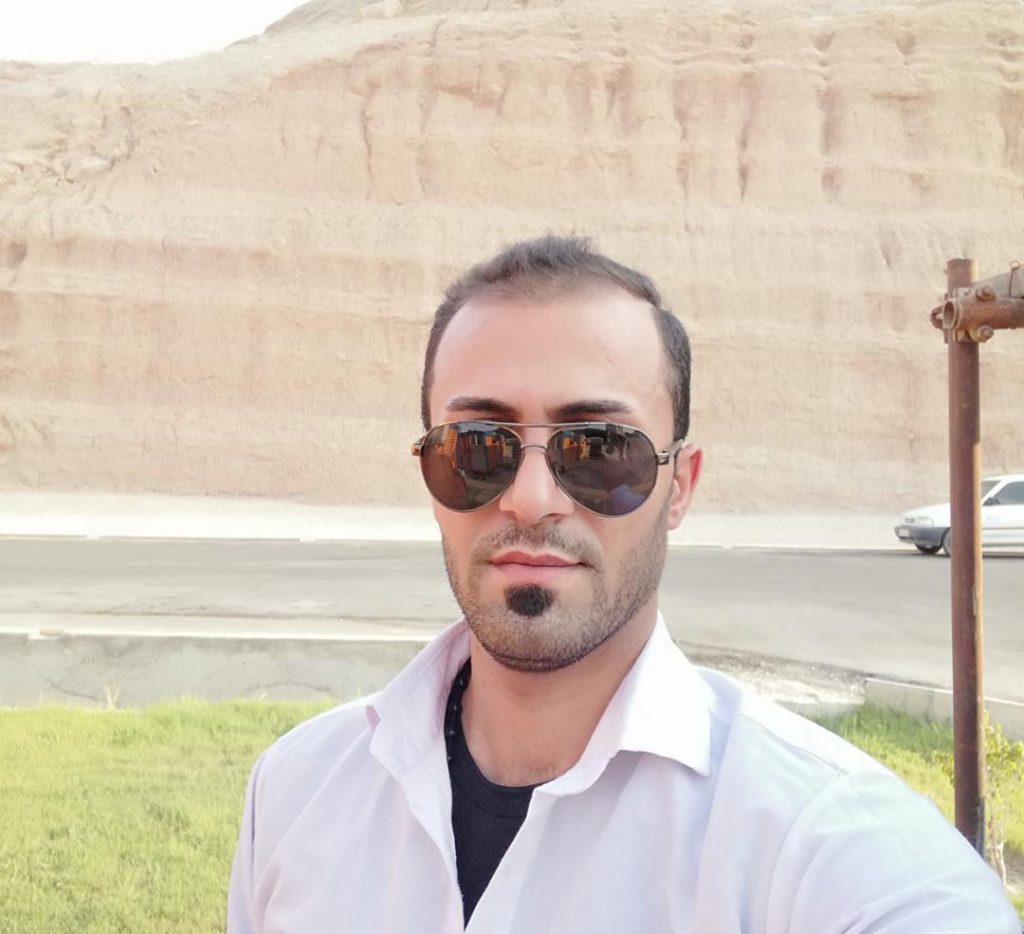 کلینیک کاشت مو دکتر شبان در بیرجند