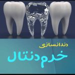 لابراتوار دندانسازی خرم‌دنتال بهاروند در لرستان خرم‌آباد