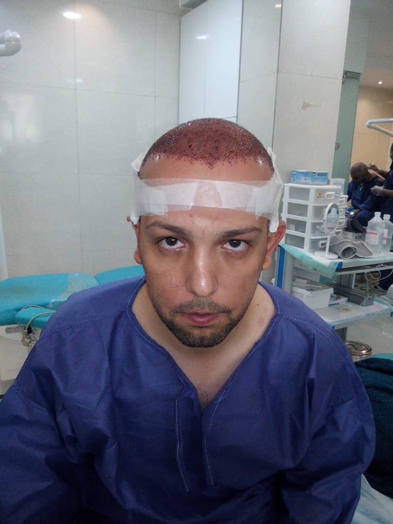 کلینیک کاشت مو دکتر شبان در بیرجند