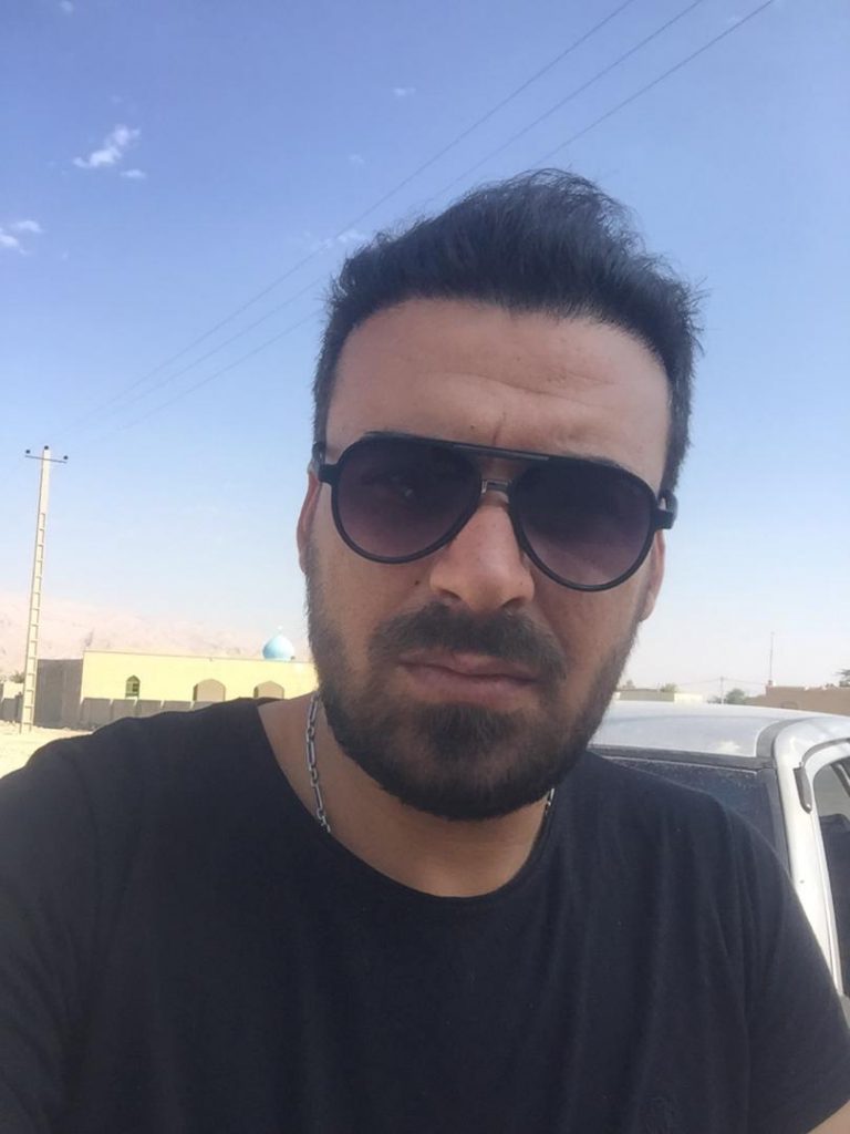 کلینیک کاشت مو دکتر شبان در بیرجند