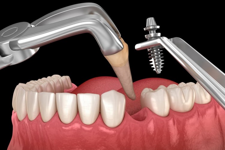 دندانسازی علیباشی در بجنورد کشانک دندانسازی علیباشی در بجنورد کشانک