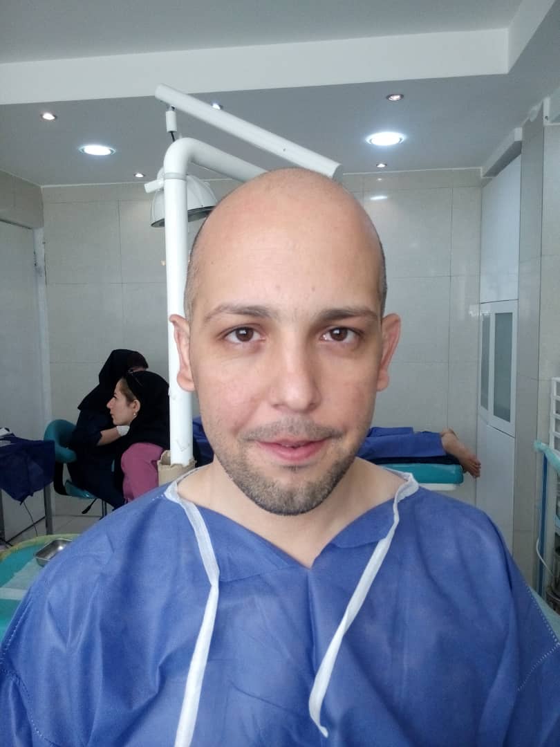 کلینیک کاشت مو دکتر شبان در بیرجند