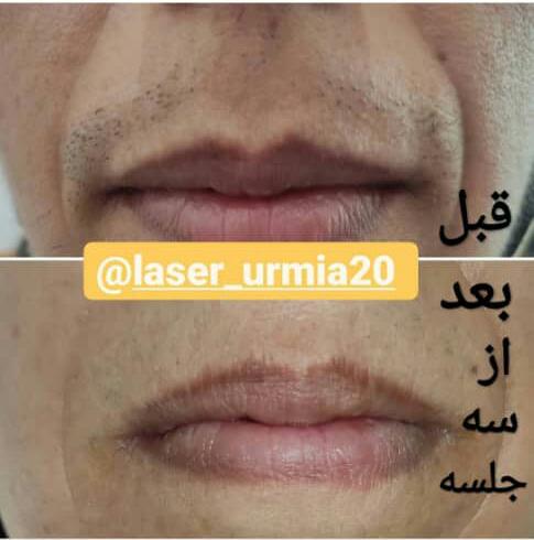 کلینیک پوست مو و لیزر مرندی در ارومیه کلینیک پوست مو و لیزر مرندی در ارومیه