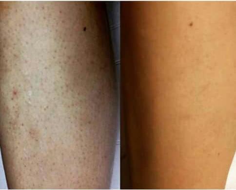 کلینیک پوست مو و لیزر مرندی در ارومیه کلینیک پوست مو و لیزر مرندی در ارومیه