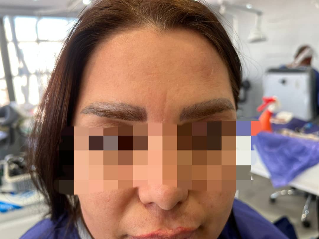 کلینیک کاشت مو دکتر شبان در بیرجند