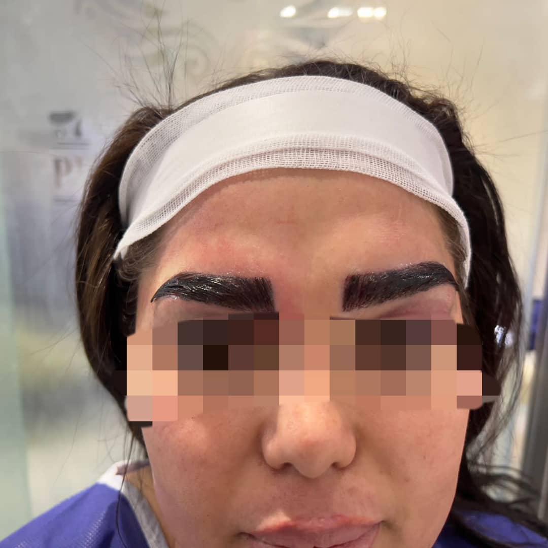 کلینیک کاشت مو دکتر شبان در بیرجند