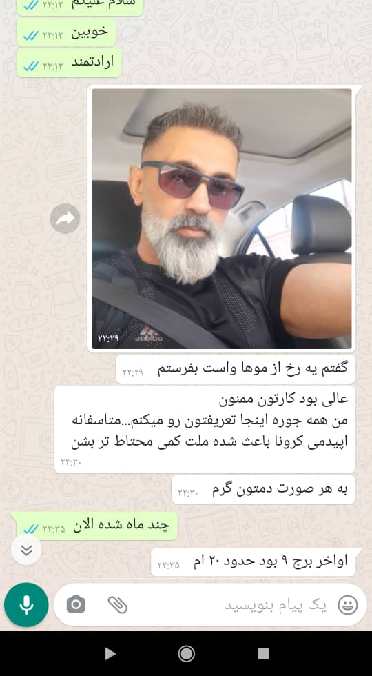 کلینیک کاشت مو دکتر شبان در بیرجند