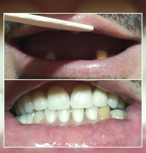 لابراتوار دندانسازی خرم‌دنتال بهاروند در لرستان خرم‌آباد