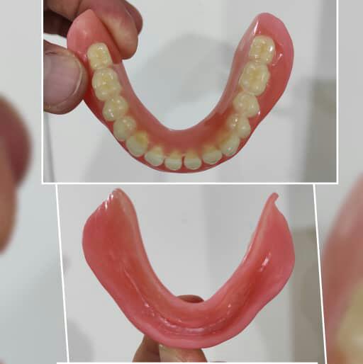 لابراتوار دندانسازی خرم‌دنتال بهاروند در لرستان خرم‌آباد