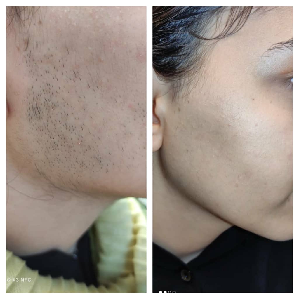 کلینیک پوست مو و لیزر مرندی در ارومیه کلینیک پوست مو و لیزر مرندی در ارومیه