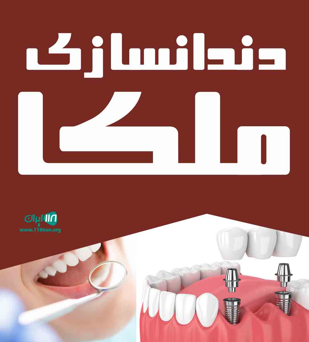 دندانسازی ملکا در مشهد
