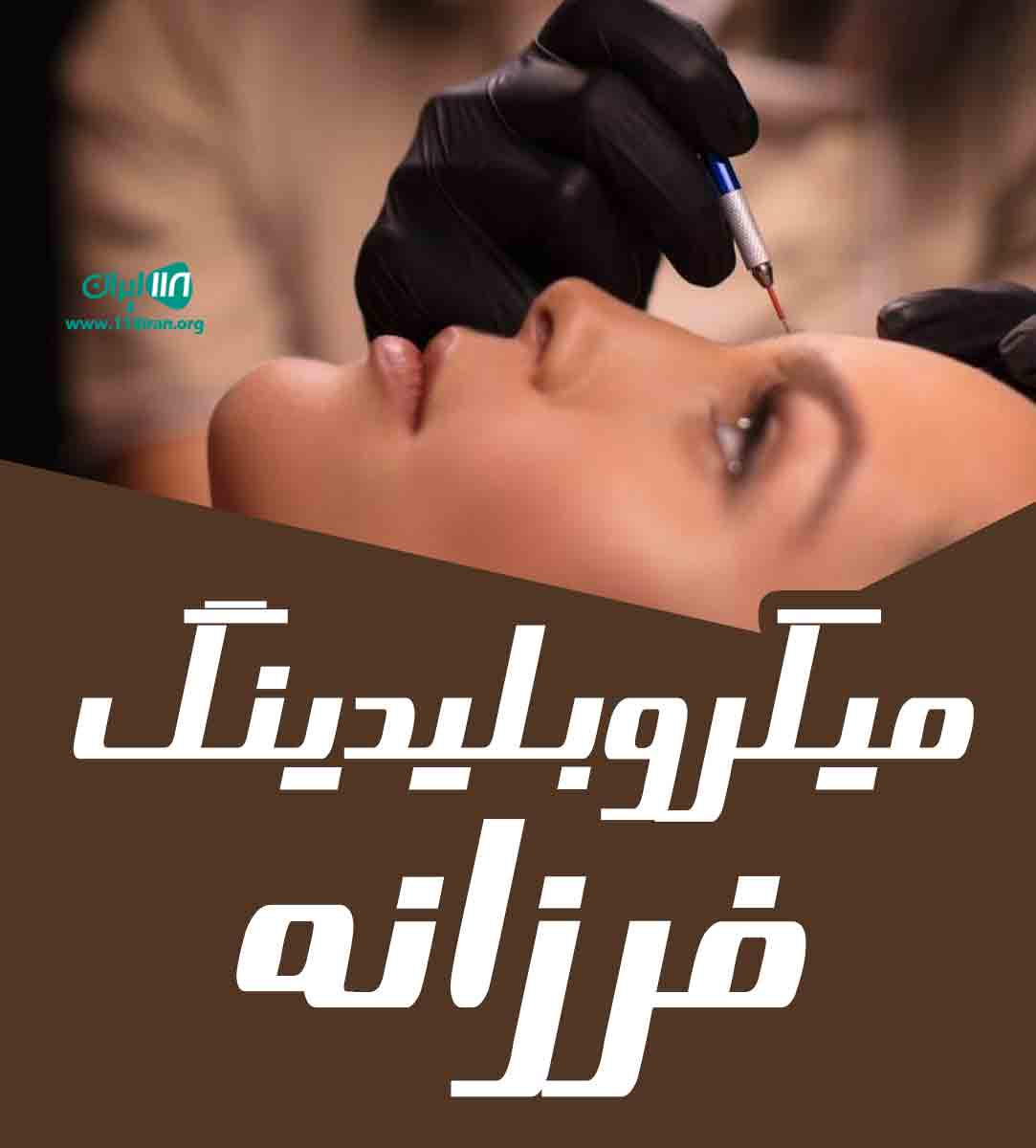 میکروبلیدینگ فرزانه در رشت