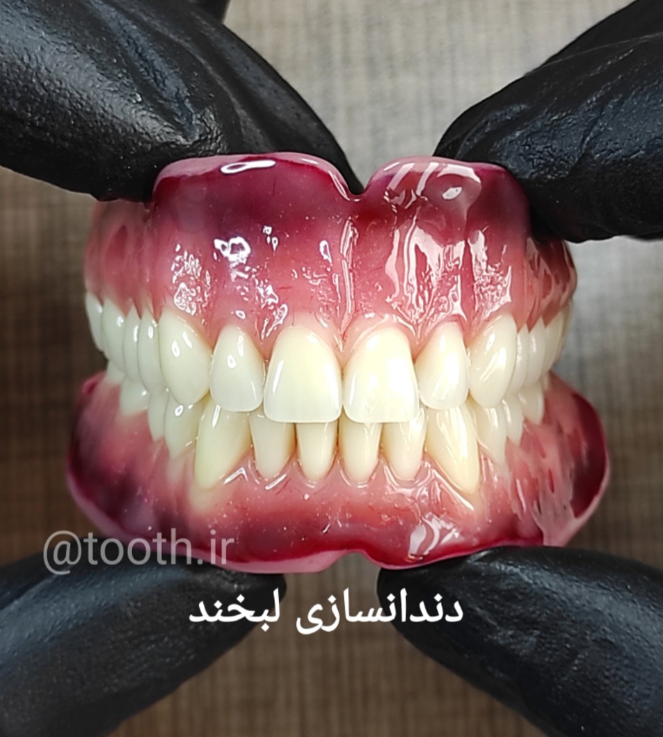 دندانسازی لبخند در بندرعباس دندانسازی لبخند در بندرعباس